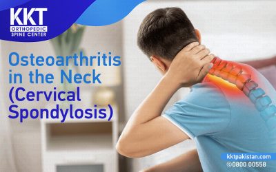 Osteoarthritis in the Neck (Cervical Spondylosis)