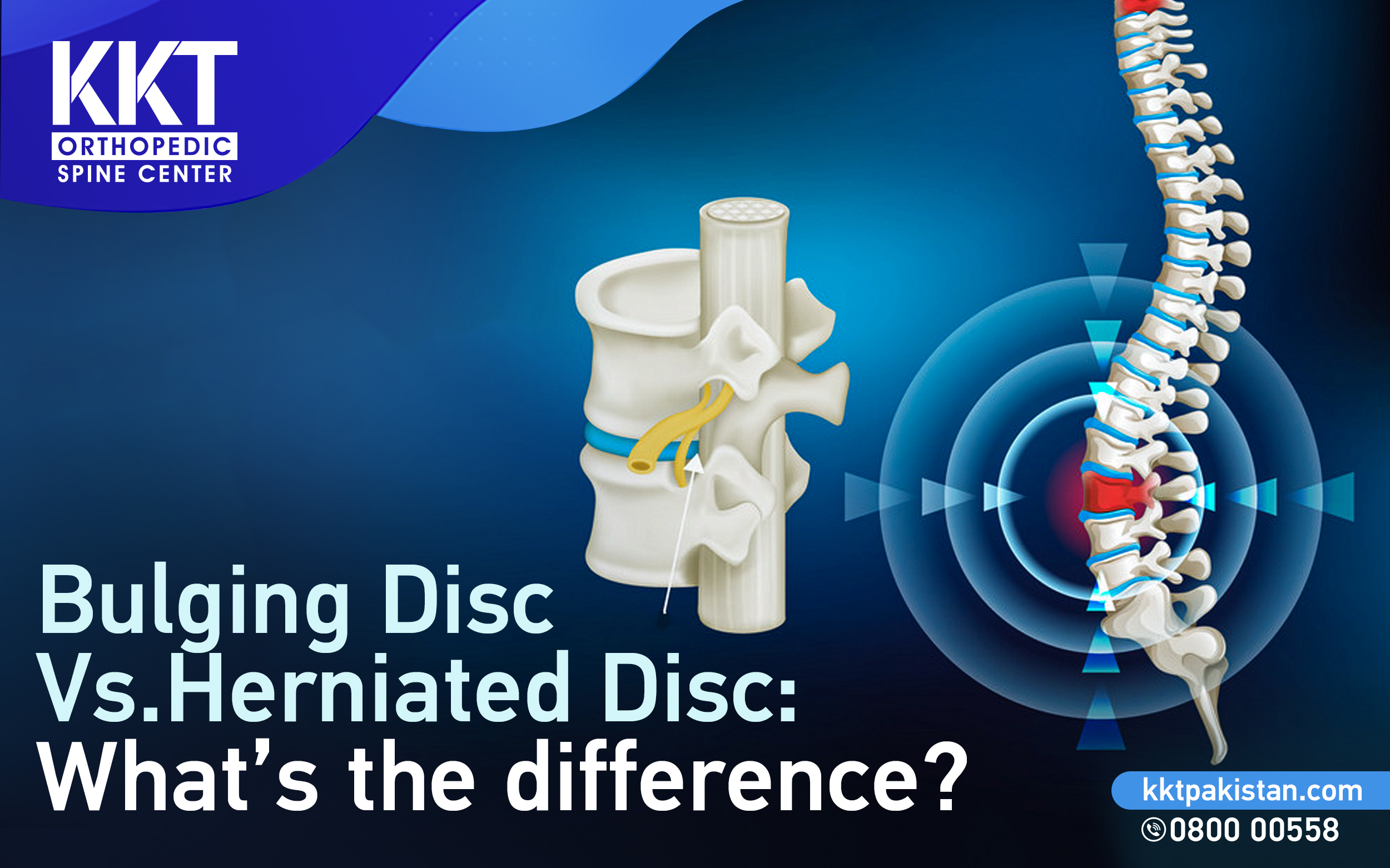 Bulging Disc Vs Herniated Disc Whats The Difference Testingform